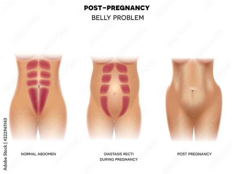 الجدول الزمني للتعافي بعد استخدام سايتوتك في السعودية